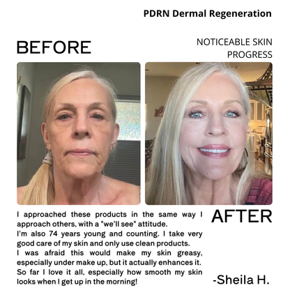 Before and after comparison of skin with text about PDRN Dermal Regeneration and a testimonial.