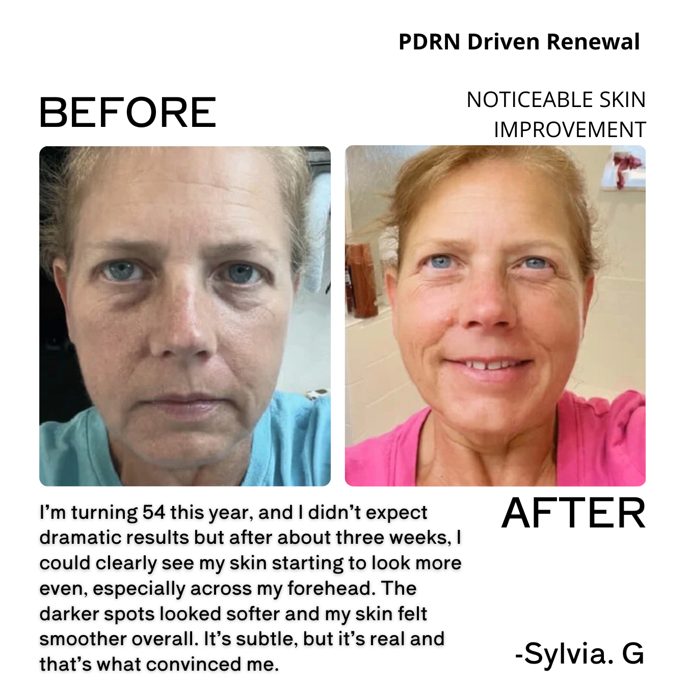 Before and after comparison of a woman's skin with text about PDRN-driven renewal and visible skin improvement.